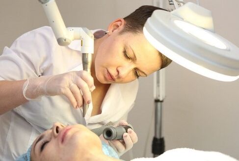 human papillomavirus removal with laser