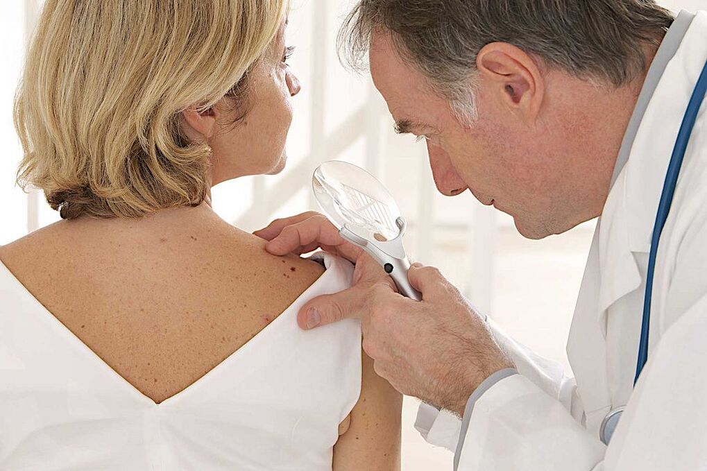 diagnosis of human papillomavirus